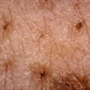 Skin captured under LED light, showing texture and fine surface detail