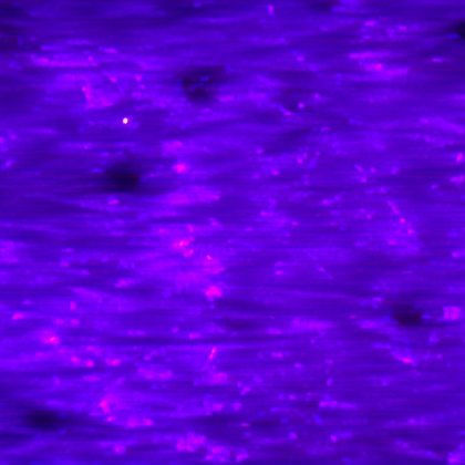 The same skin area captured under UV light, showing fluorescence patterns